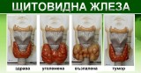 25-31 май: Седмица за повишаване информираността относно заболяванията на щитовидната жлеза