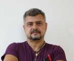Доц. д-р Лъчезар Лозанов: Базедовата болест мъчи повече жените